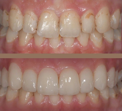 Slider image (4) UltimaDent